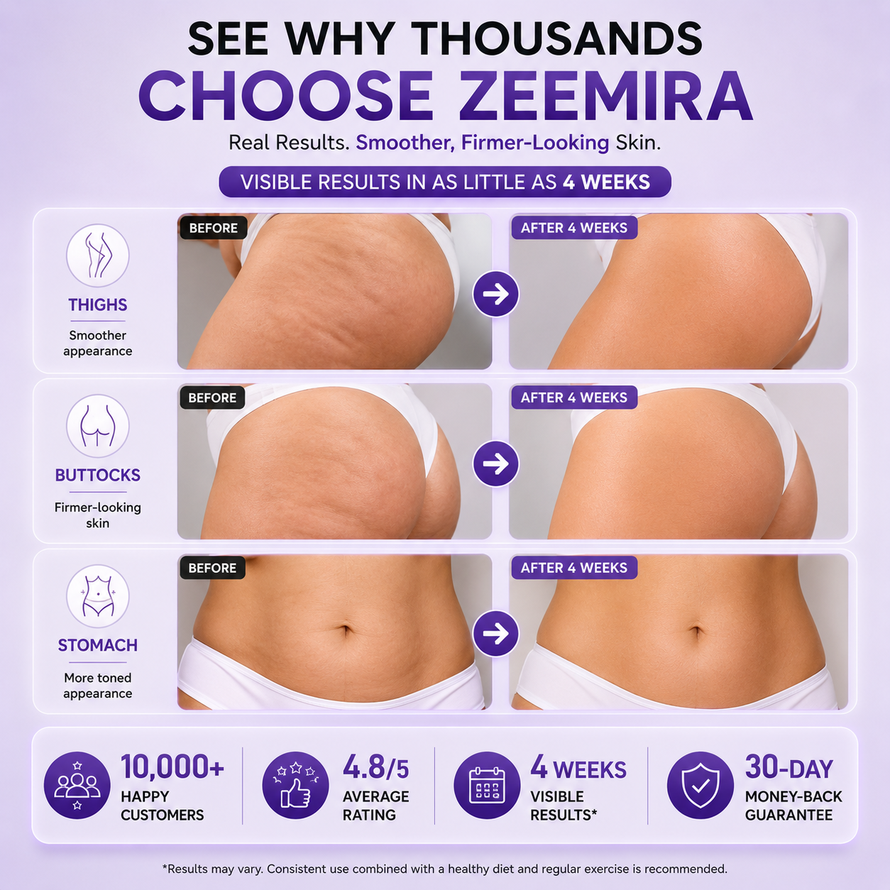 Zeemira Anti-Cellulite Massager